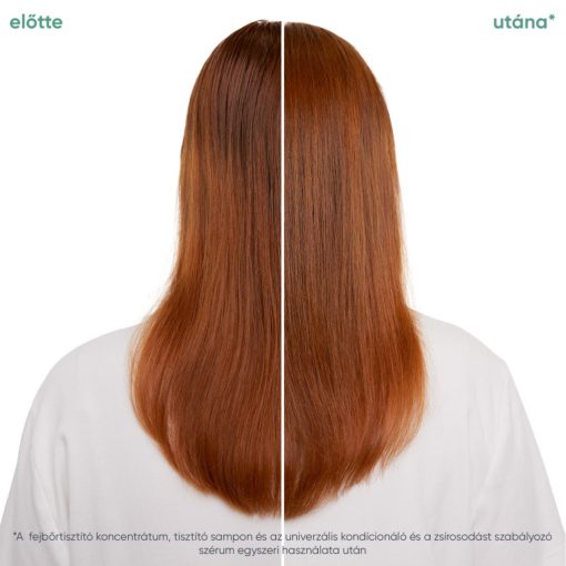 Matrix Biolage  Scalp Sync Clarifying tisztító sampon zsíros fejbőrre 1000 ml