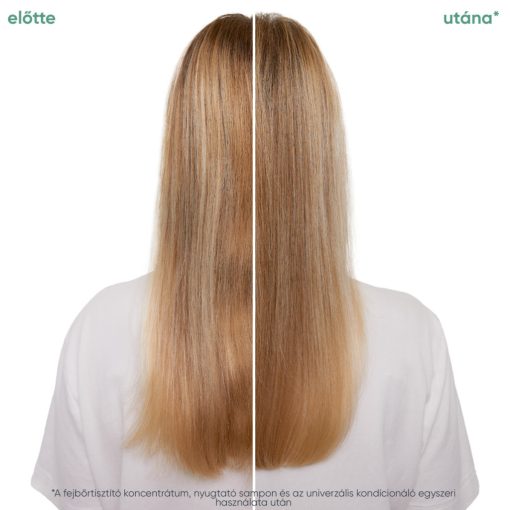 Matrix Biolage  Scalp Sync Calming fejbőr nyugtató sampon 250 ml