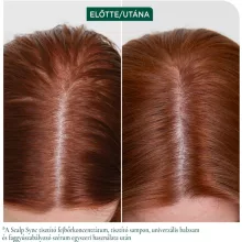 Matrix Biolage Scalp Sync Calming fejbőr nyugtató sampon 400 ml