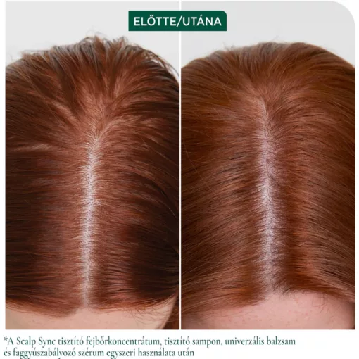 Matrix Biolage Scalp Sync Calming fejbőr nyugtató sampon 400 ml