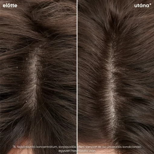 Matrix Biolage  Scalp Sync Fejbőrtisztító Koncentrátum 200 ml